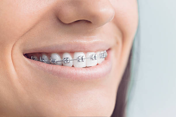 Full Mouth Reconstruction in Villas, NJ